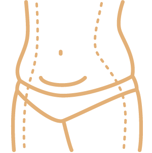 Abdominoplasty